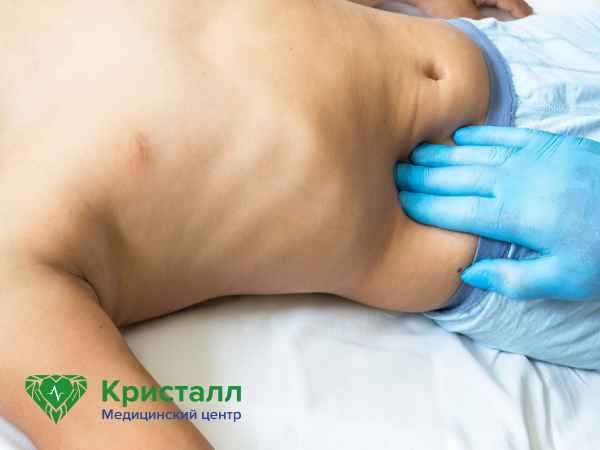 Врач проверяет апендицинт
