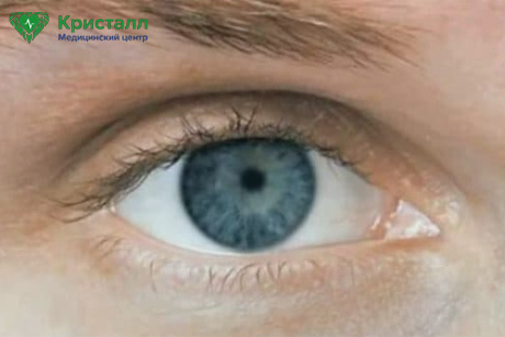Суженные зрачки